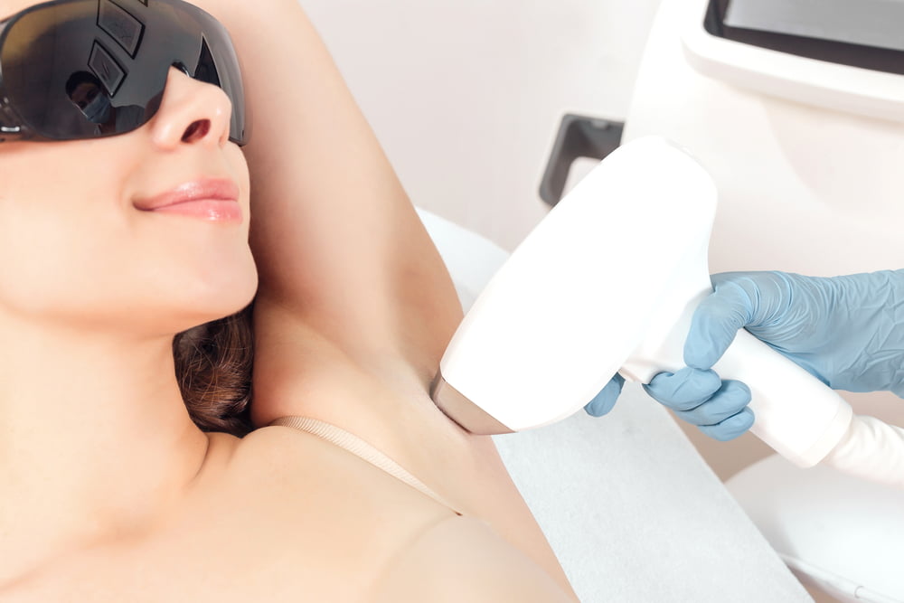 What to Expect after IPL Hair Removal or Laser Hair Removal